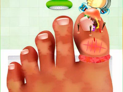 Nail Surgery Game pelin kuvakaappaus